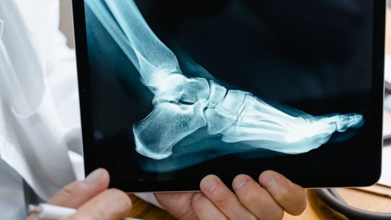 Foot